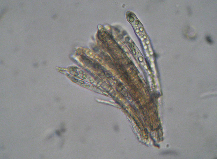 Forse non � Hymenoscyphus fructigenus ....